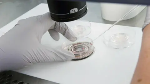 Getty Images A doctor's gloved hand holds a petri dish containing sperm under a microscope