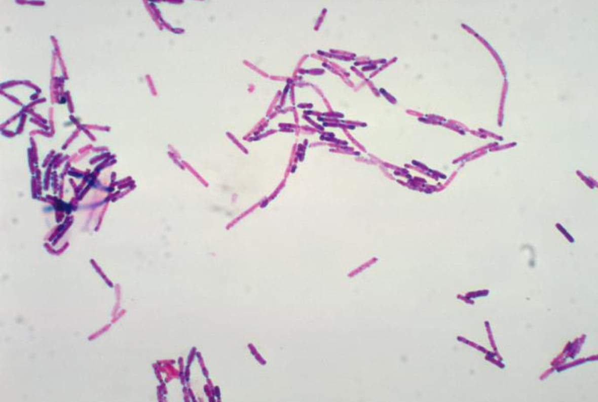 Numerous, Gram-positive, Bacillus cereus bacteria are seen in a photomicrograph.