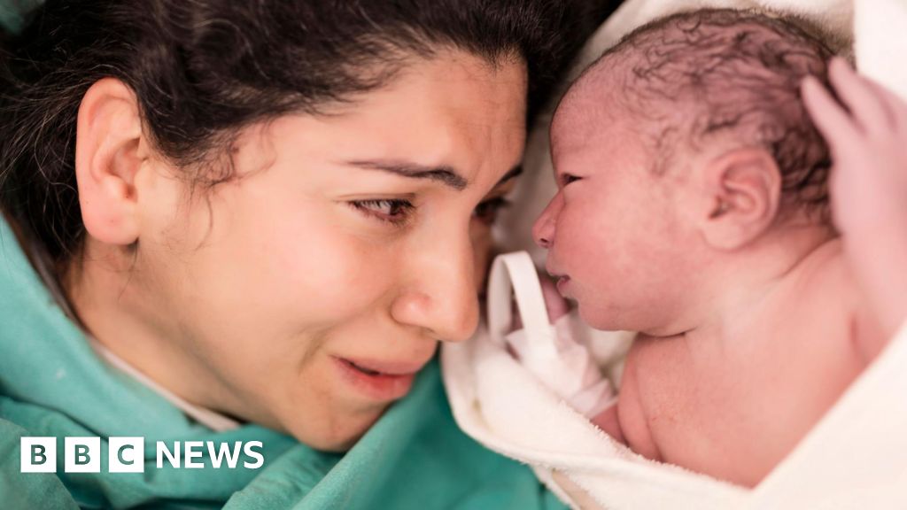 One in four babies born by Caesarean in England