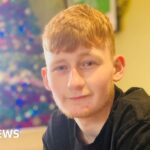 Macduff teenager who lost legs walking again for Christmas