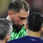 PSG Win Thriller In Monaco But Lose Gianluigi Donnarumma To Facial Injury