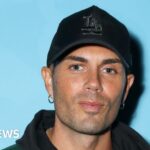 Max George from The Wanted has pacemaker fitted for heart condition