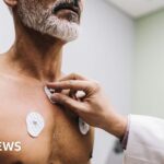 Hospitals trial AI to spot type 2 diabetes risk