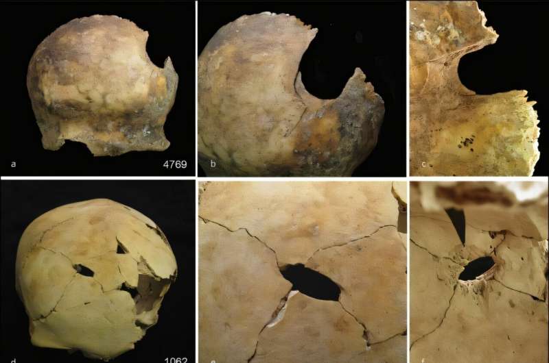 Butchered bones suggest violent 'othering' of enemies in Bronze Age Britain