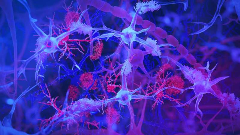 The surprising role of gut infection in Alzheimer's disease