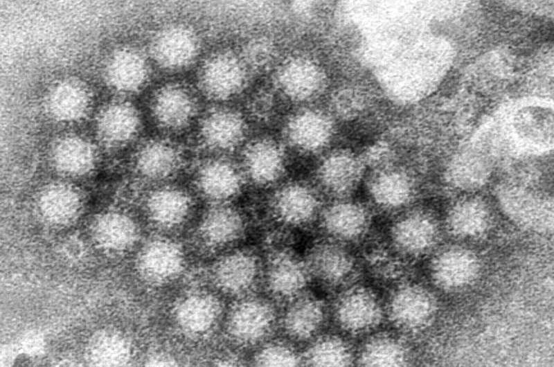 Nasty norovirus is back in full force with US cases of the stomach virus surging