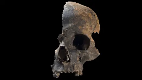 Rick Schulting Partial remains of a human skull showing signs of having suffered devastating injuries in the Bronze Age.