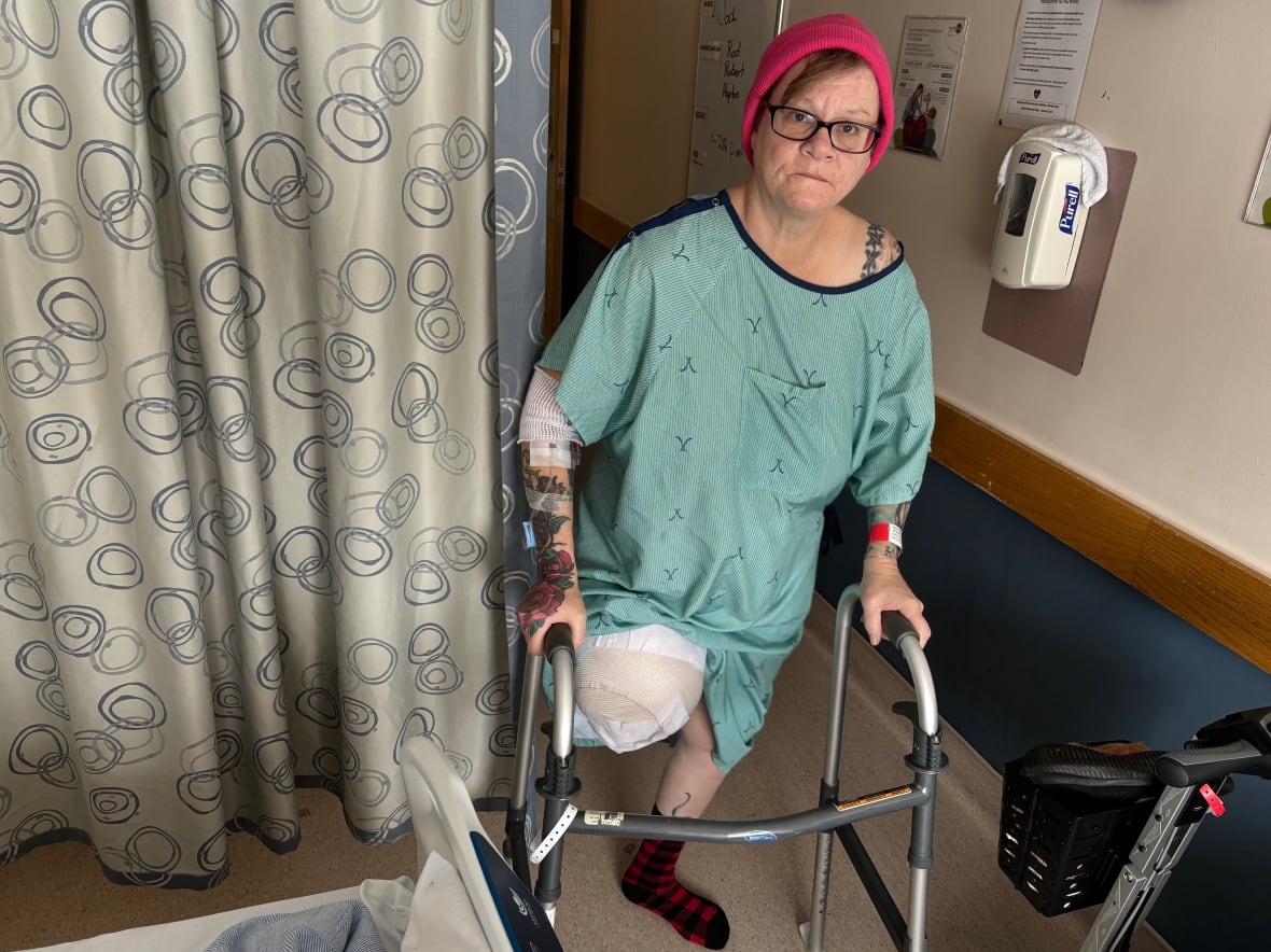 A woman in a green hospital gown and pink toque stands beside a hospital bed while holding onto a walker. Her left leg is pictured, as is her bandaged right leg that has been amputated above the knee.