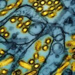 CDC confirms first severe case of H5N1 bird flu in U.S.