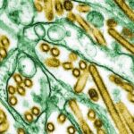 CDC Confirms First US Case of Severe Bird Flu