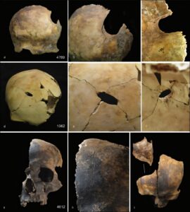 Butchered bones suggest violent ‘othering’ of enemies in Bronze Age Britain