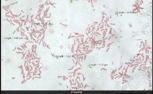 IIT Researchers Make Bacteria Eat Carbon Dioxide, Methane For Cleaner Fuel