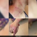 Bengaluru Woman Alleges Assault By Landlord’s Brother