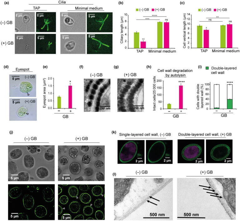 Interdisciplinary research reveals impressive adaptation mechanisms of microscopic algae