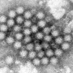 Norovirus cases surge in US, causing widespread stomach illness