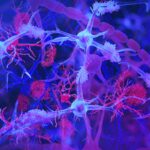 Chronic gut infection could play a role in Alzheimer’s development