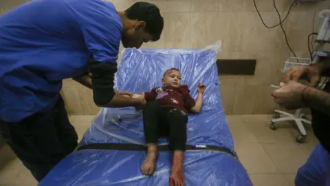 Getty Images An injured child with bare feet lies on a blue bed covered with transparent plastic sheeting, while a doctor dressed in a blue overall bends over him and holds his right arm.