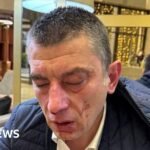 Georgian opposition leader beaten up and blames governing party members