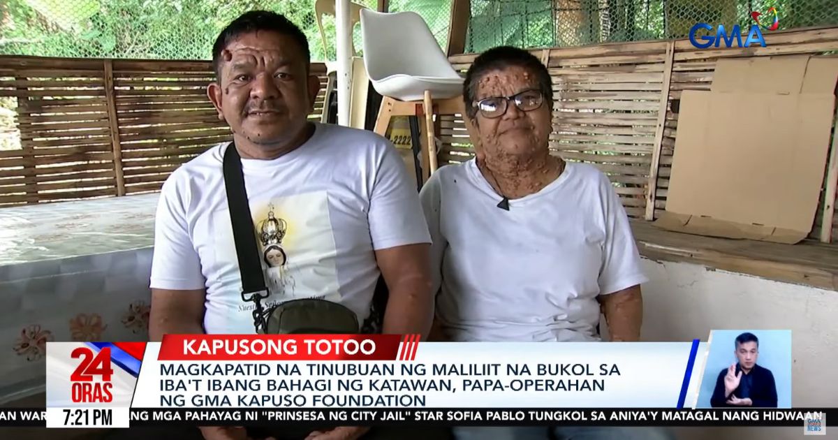 2 siblings with multiple lumps in their bodies to undergo operation thanks to GMA Kapuso Foundation