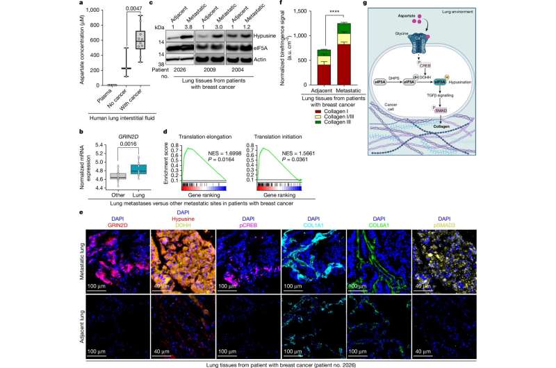 Researchers reveal why the lung is a frequent site of cancer metastasis