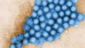 Norovirus cases are on the rise. Here’s what you need to know about this nasty bug