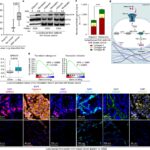 Researchers reveal why the lung is a frequent site of cancer metastasis