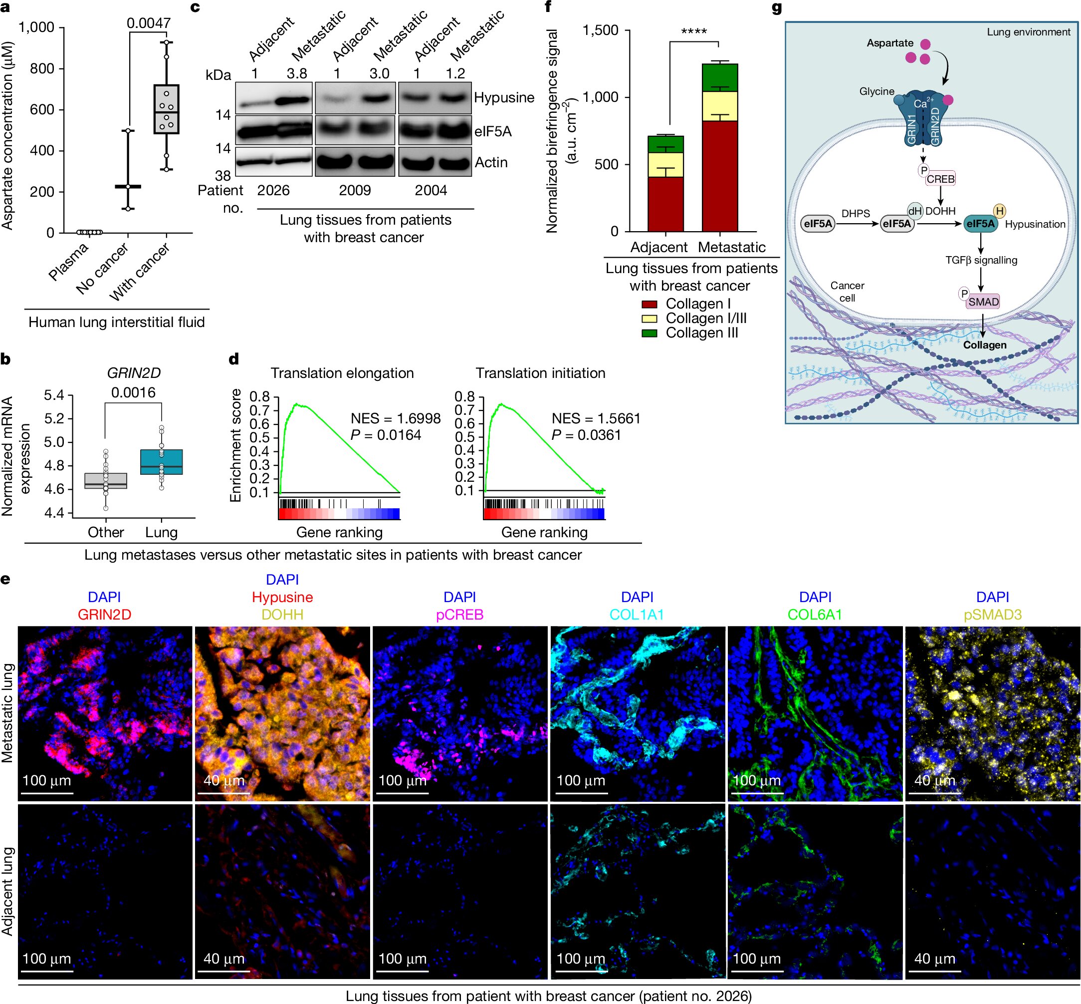 Researchers reveal why the lung is a frequent site of cancer metastasis